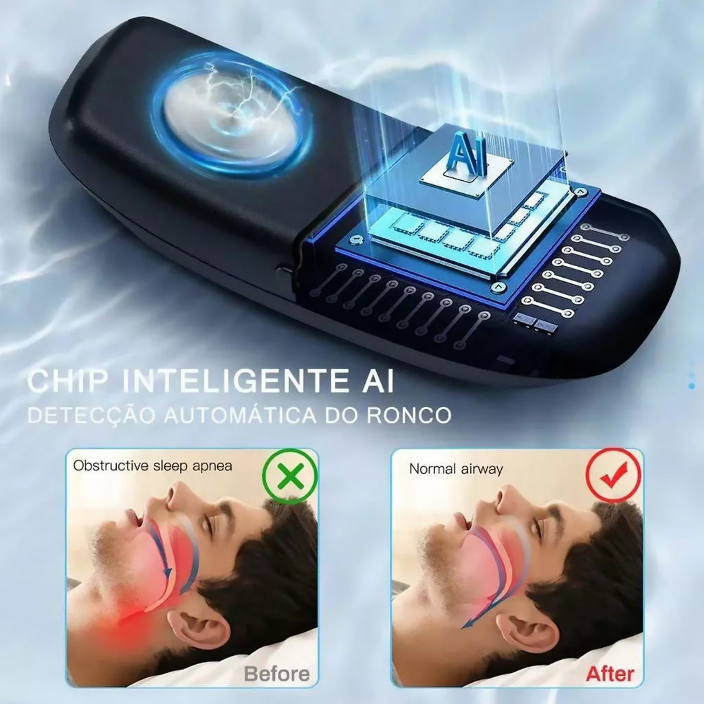 ⏰Limited-time ✨✦Dispositivo Inteligente Anti-Ronquidos